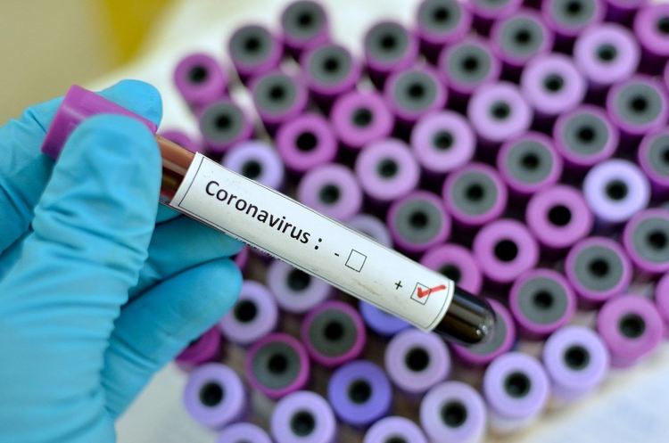Спад на заболелите от COVID-19 за последните две седмици в област Пловдив