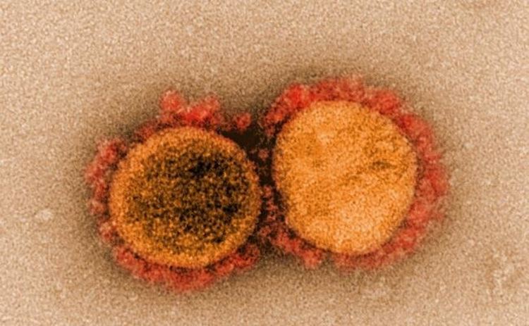 Вирусолози съобщават за потенциално лечение срещу SARS-CoV-2