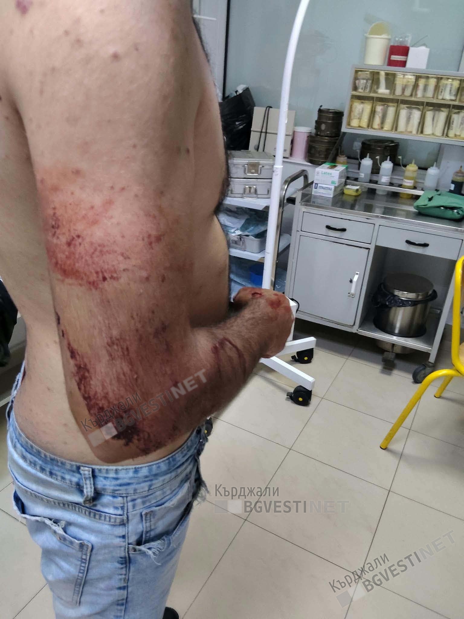 Младежът, обвиняващ полицаи за побой, е пребил кърджалиец пред заведение в града,твърдят свидетели?